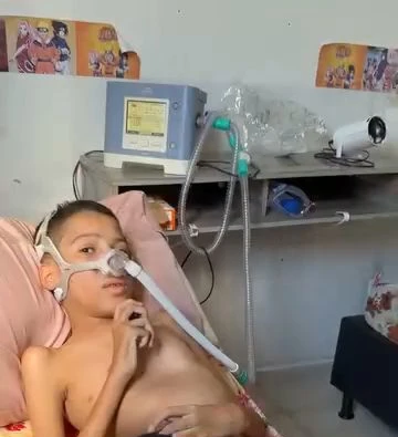 Kauê com a máscara do aparelho